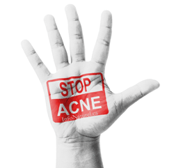 L’acné est un problème chez les adolescent(e)s
